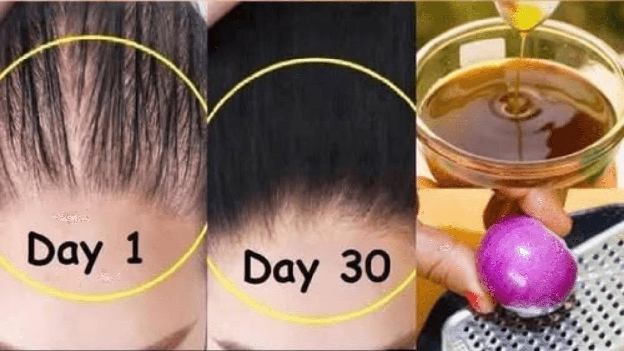 How to Make Onion Hair Oil for Faster Hair Growth and to Stop Hair Fall